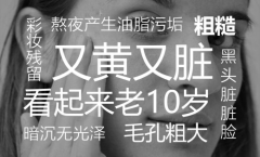 CZC品牌针叶樱桃亮颜黑金面膜：肌肤清道夫还你清洁完